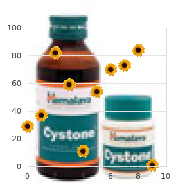 Geen Sandford Davison syndrome