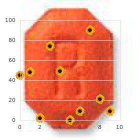 Chromosome 1, monosomy 1q32 q42