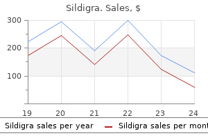 buy 25 mg sildigra