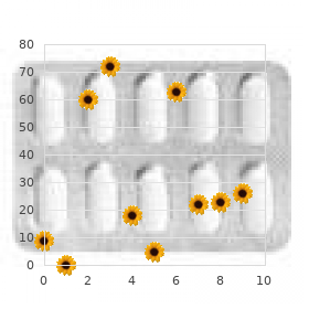 18-Hydroxylase deficiency, rare (NIH)