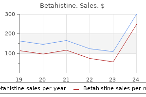 16 mg betahistine amex