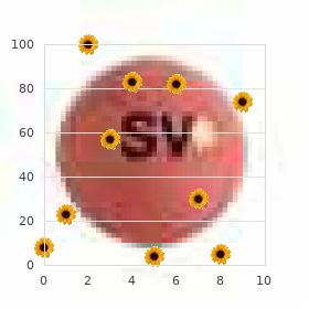 Monosomy X