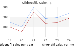 cheap 25 mg sildenafil free shipping