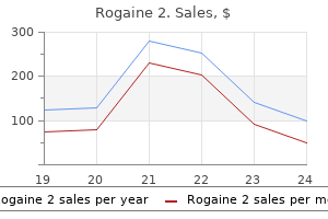 buy 60 ml rogaine 2 with amex